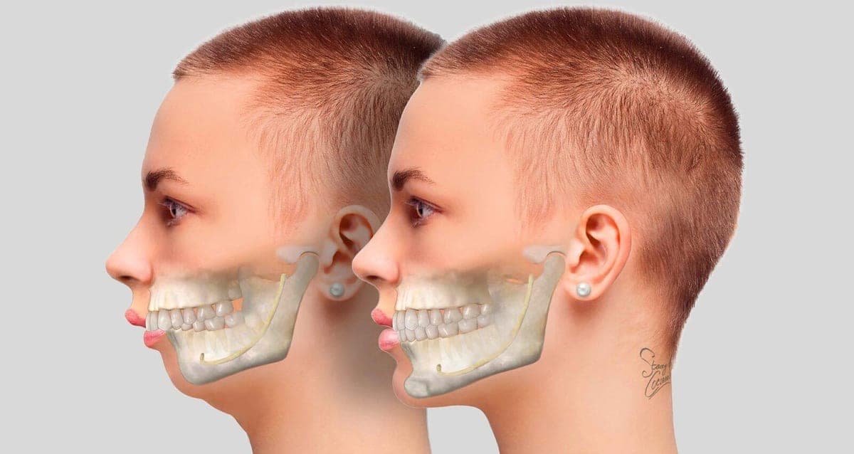 Oral & Maxillofacial Surgery